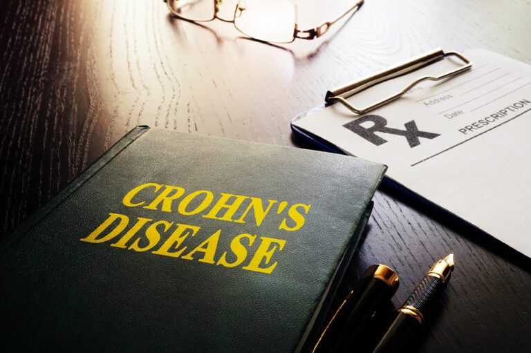 Warning signs of Crohn’s disease