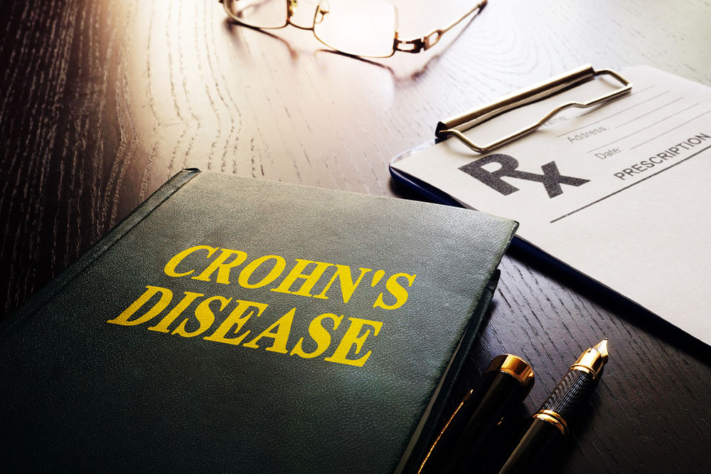 Warning signs of Crohn’s disease